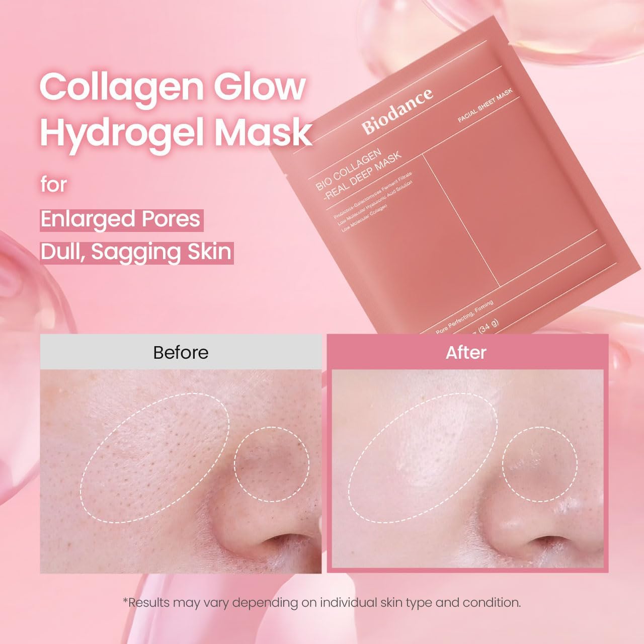 BIODANCE Bio-Collagen Real Deep Mask – Hydrogel Face Mask with Collagen, Overnight Hydrating Treatment, Pore Care & Elasticity, K-Beauty, 4 Masks