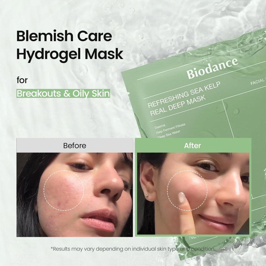 BIODANCE Bio-Collagen Real Deep Mask – Hydrogel Face Mask with Collagen, Overnight Hydrating Treatment, Pore Care & Elasticity, K-Beauty, 4 Masks