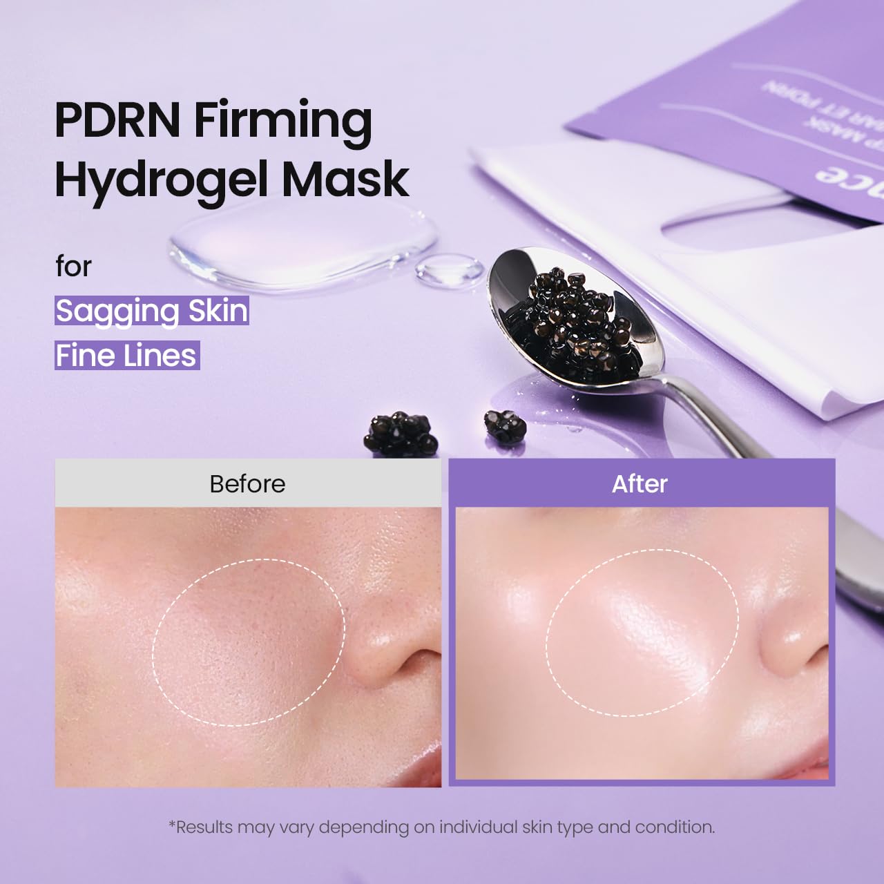 BIODANCE Bio-Collagen Real Deep Mask – Hydrogel Face Mask with Collagen, Overnight Hydrating Treatment, Pore Care & Elasticity, K-Beauty, 4 Masks